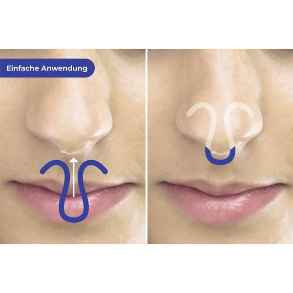 Set cârlige anti-sforăit 3 buc. – Maximex-image-1